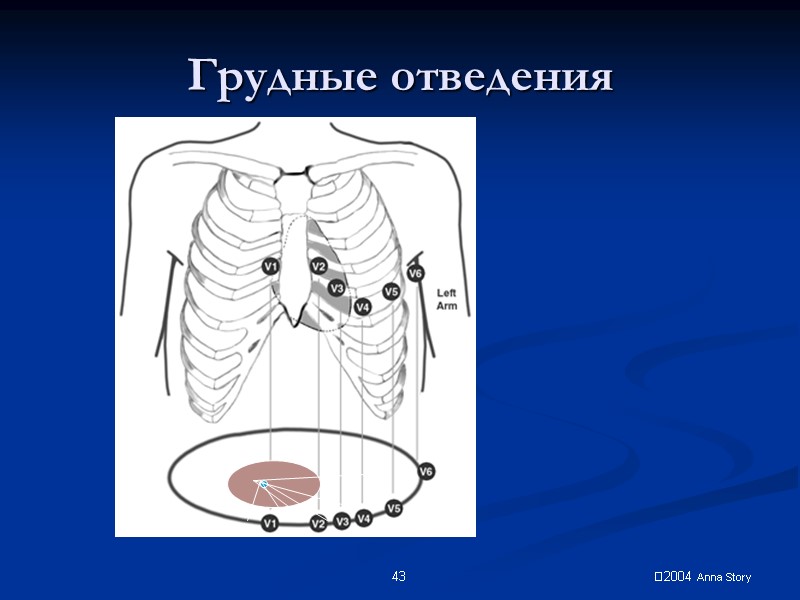 2004 Anna Story 43 Грудные отведения